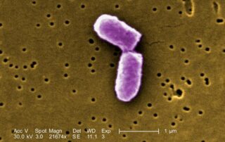 Escherichia coli